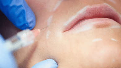 Wie Filler für Gesicht helfen, ein jugendliches Aussehen zu bewahren