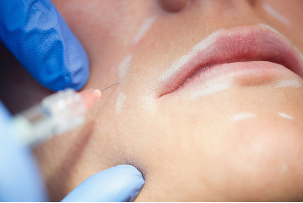Wie Filler für Gesicht helfen, ein jugendliches Aussehen zu bewahren